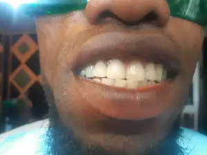 Teeth Whitening Studio