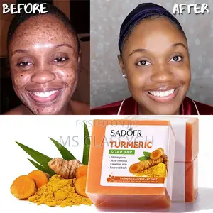 100g Turmeric Ginger Soap Anti Acne Skin Brighten Face Clean