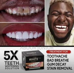 Teeth Whiter