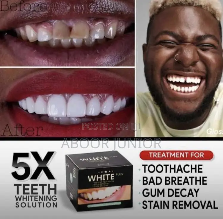 Teeth Whiter