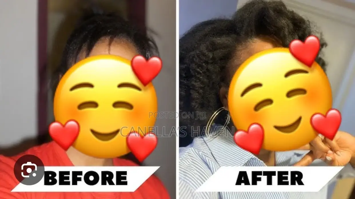 Mizani Miracle Length Hairline and Root Stimulator