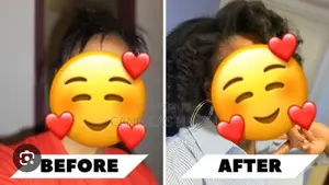 Mizani Miracle Length Hairline and Root Stimulator
