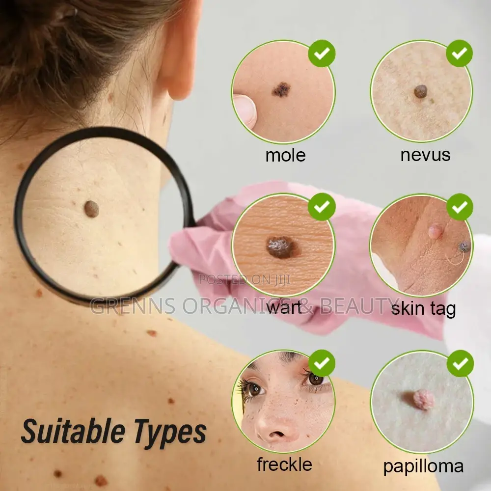 Level 15 Plasma Pen for Dark Spots, Skin Tags,Mole,Warts Etc