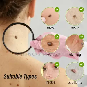 Level 15 Plasma Pen for Dark Spots, Skin Tags,Mole,Warts Etc