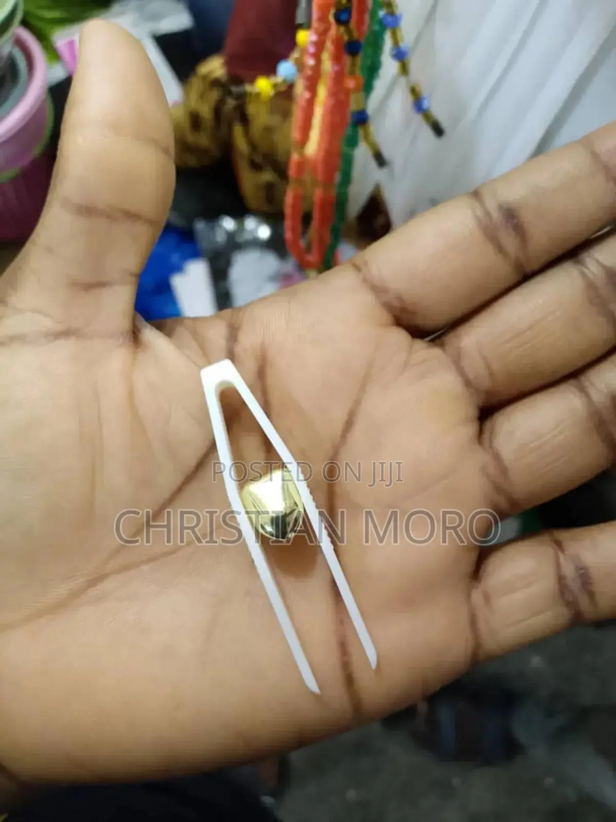 Tooth Crown