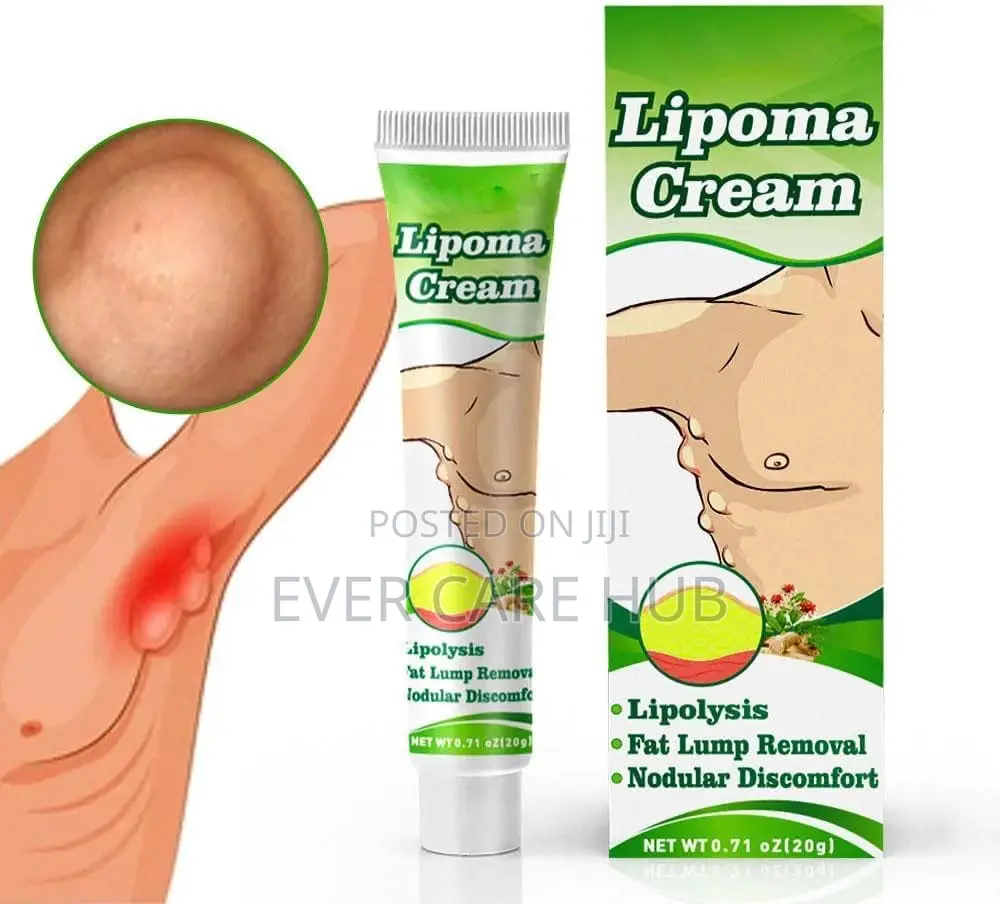 Lipoma Cream