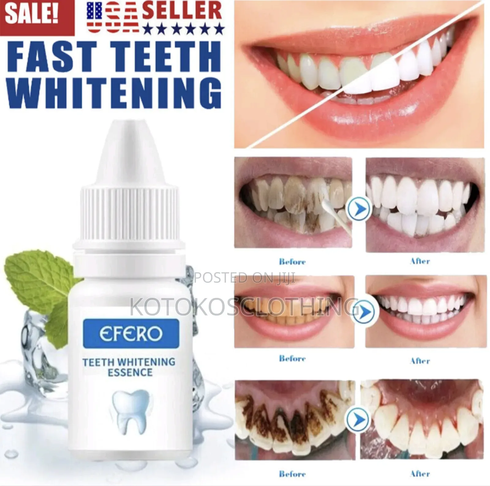 Efero Teeth Whitening