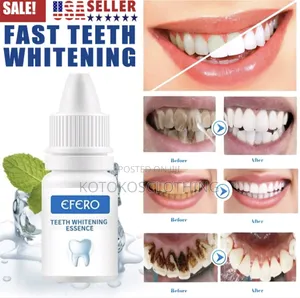 Efero Teeth Whitening