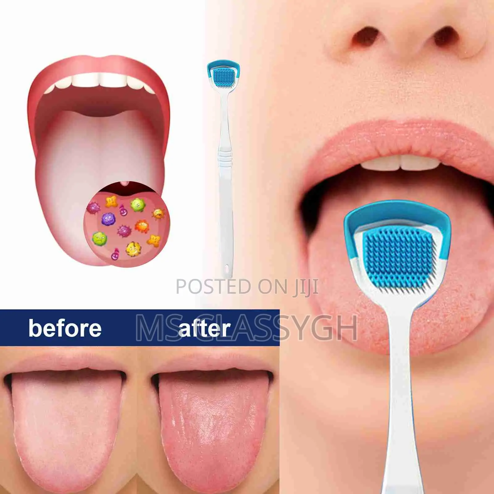 Silicone Tongue Scrapers - Deep Cleaning Reduce Breath