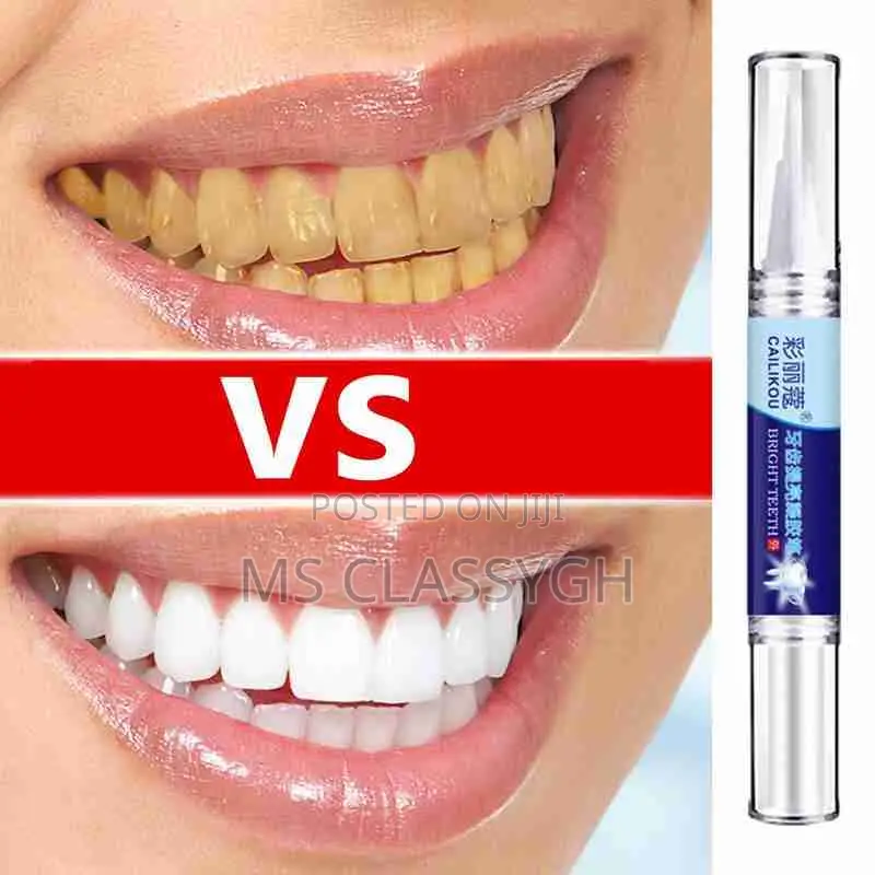 Teeth Whitening Pen Professional And Stain Remover