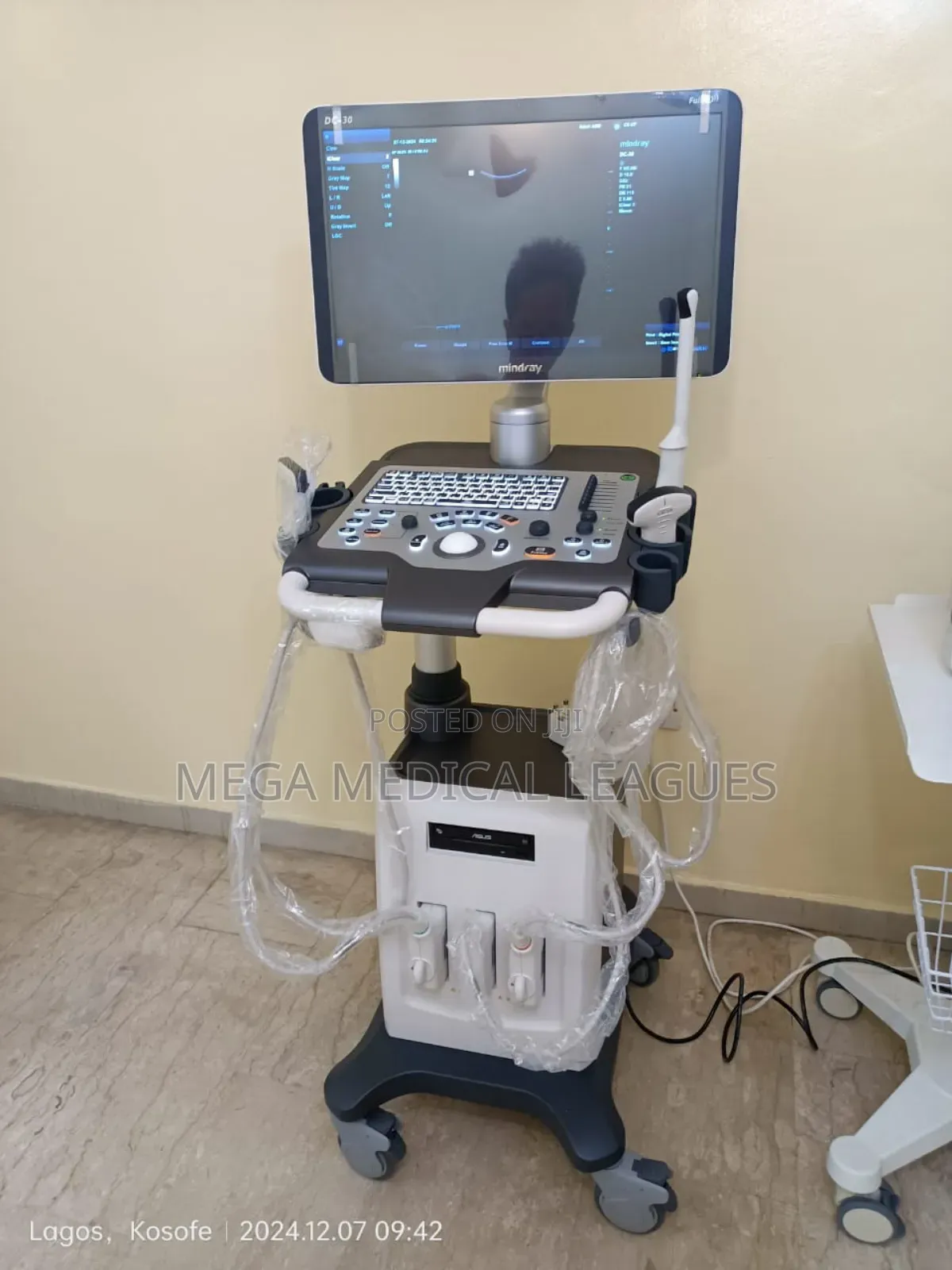 Mindray DC30 Full HD Ultrasound
