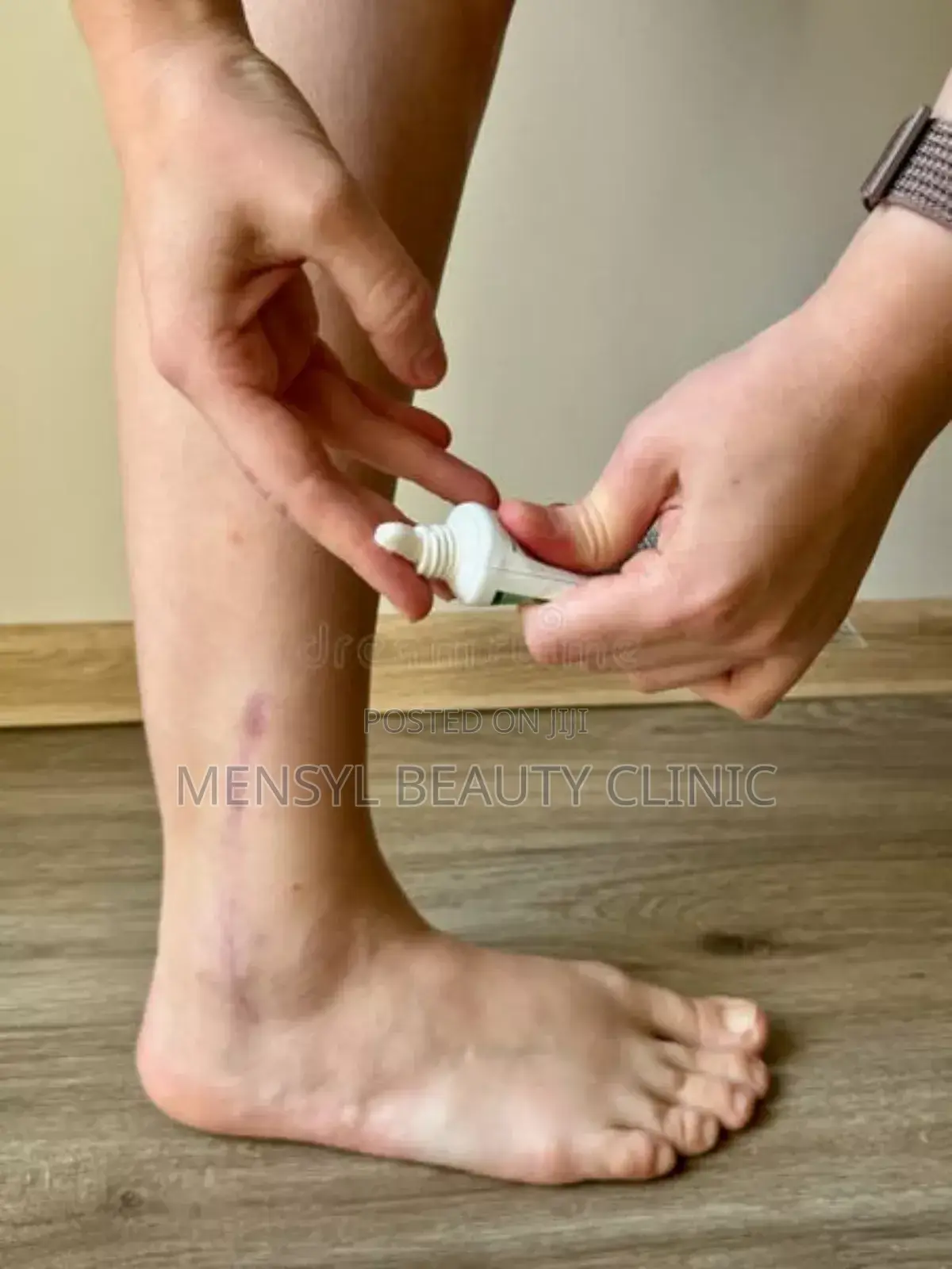 Silicone Scar Gel for All Type of Scar Including Keloid