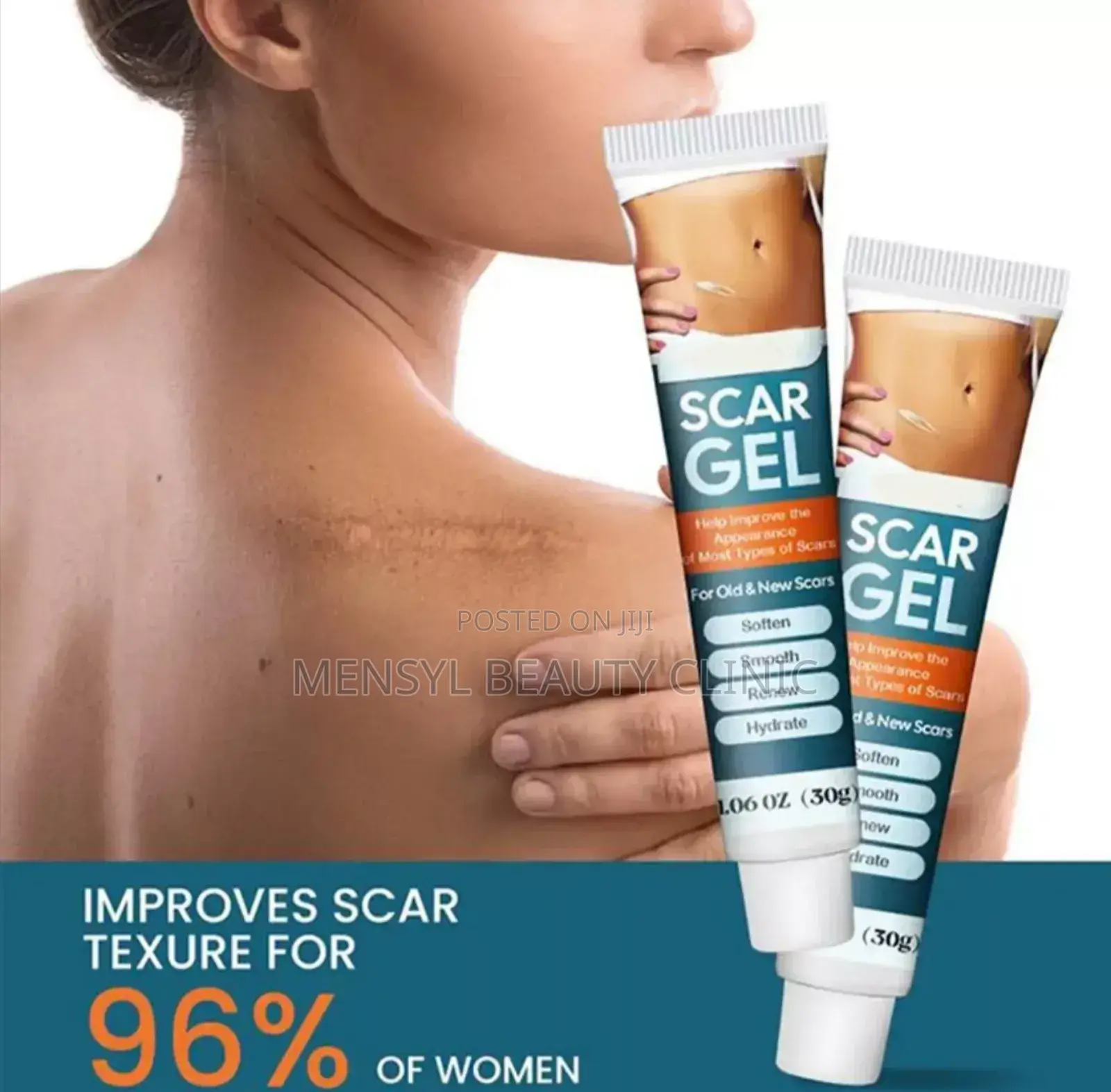 Silicone Scar Gel for All Type of Scar Including Keloid