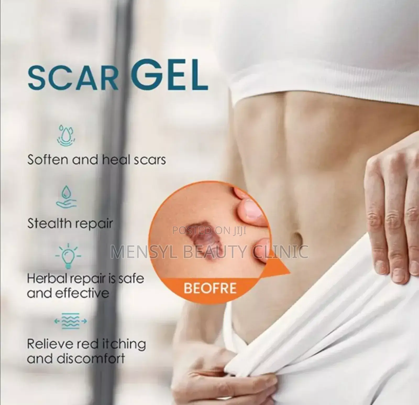 Silicone Scar Gel for All Type of Scar Including Keloid