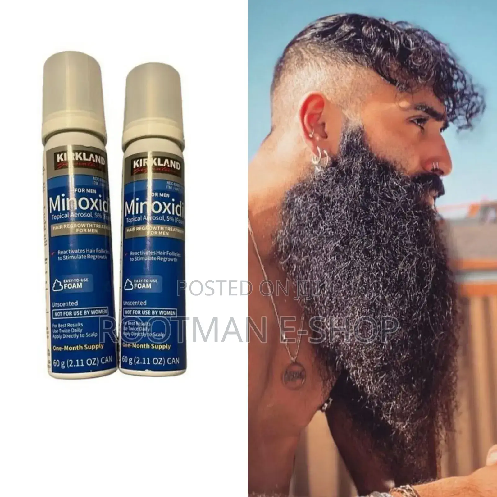 Kirkland Minoxidil Hair/ Beard Growth Works 100%