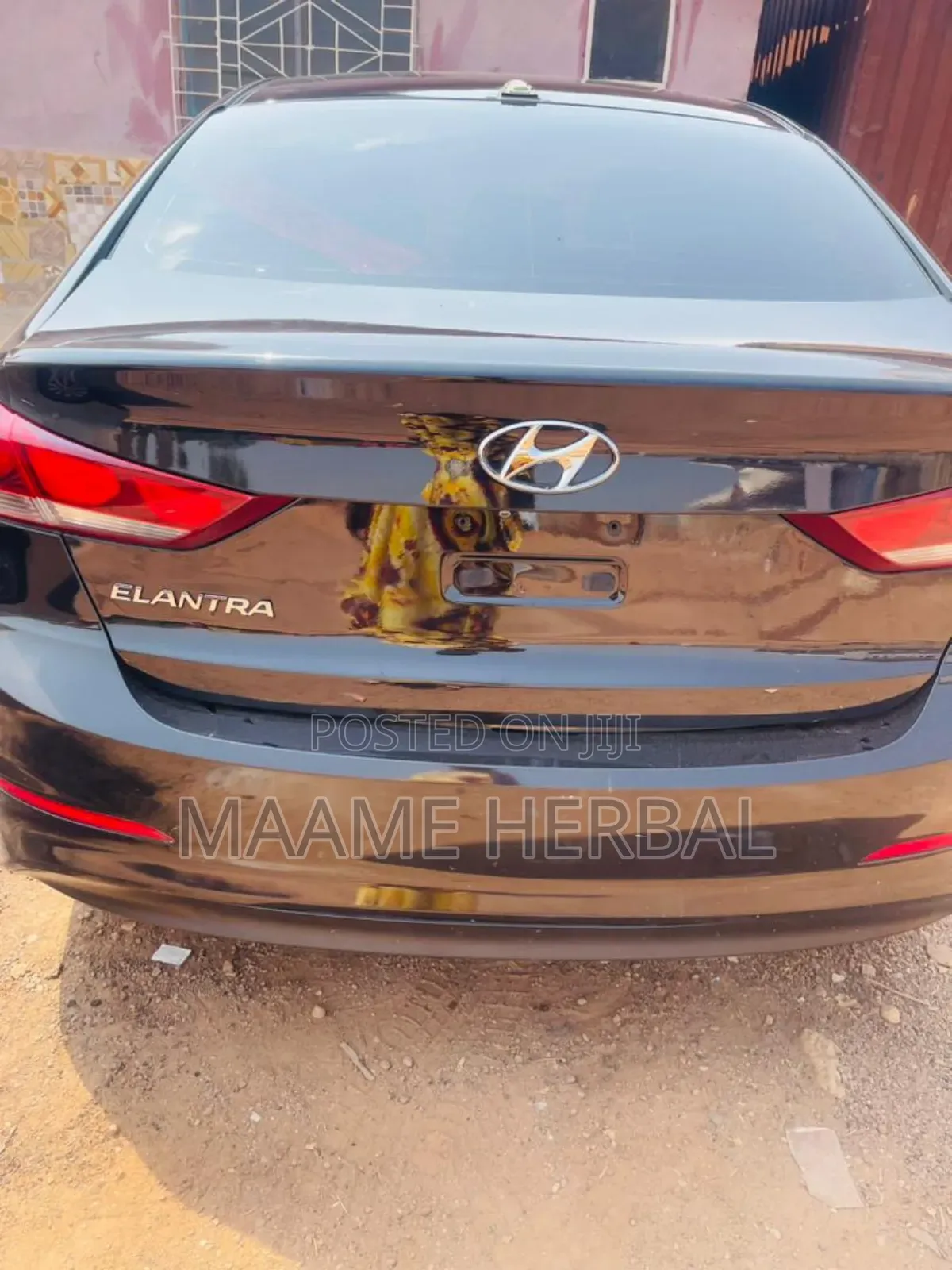 Hyundai Elantra 2016-2018 Black