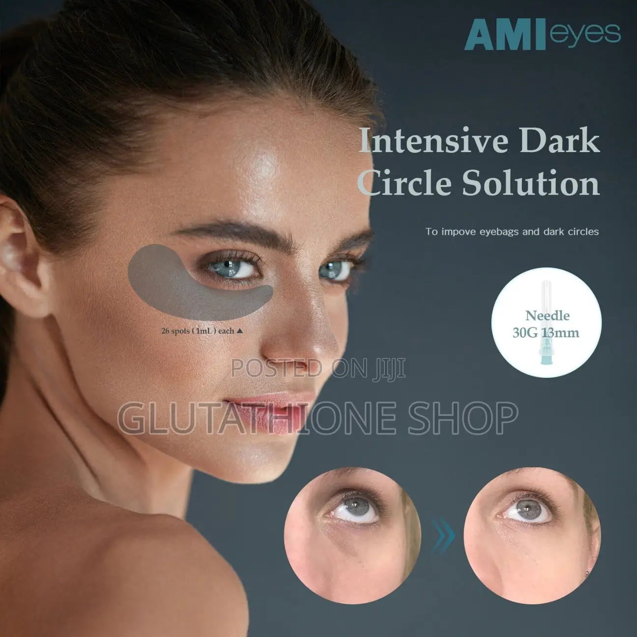 Ami Eyes Fillers for Dark Under Eye