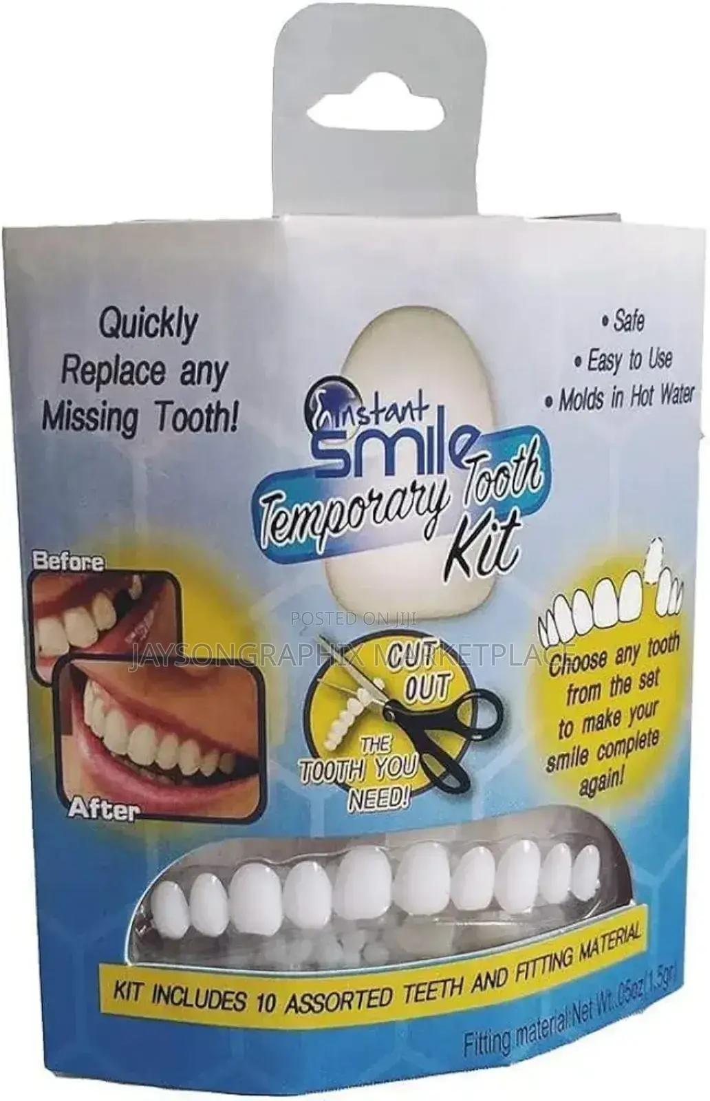 Instant Smile Temporary Tooth Kit