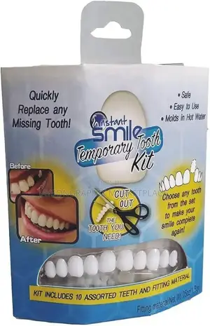 Instant Smile Temporary Tooth Kit