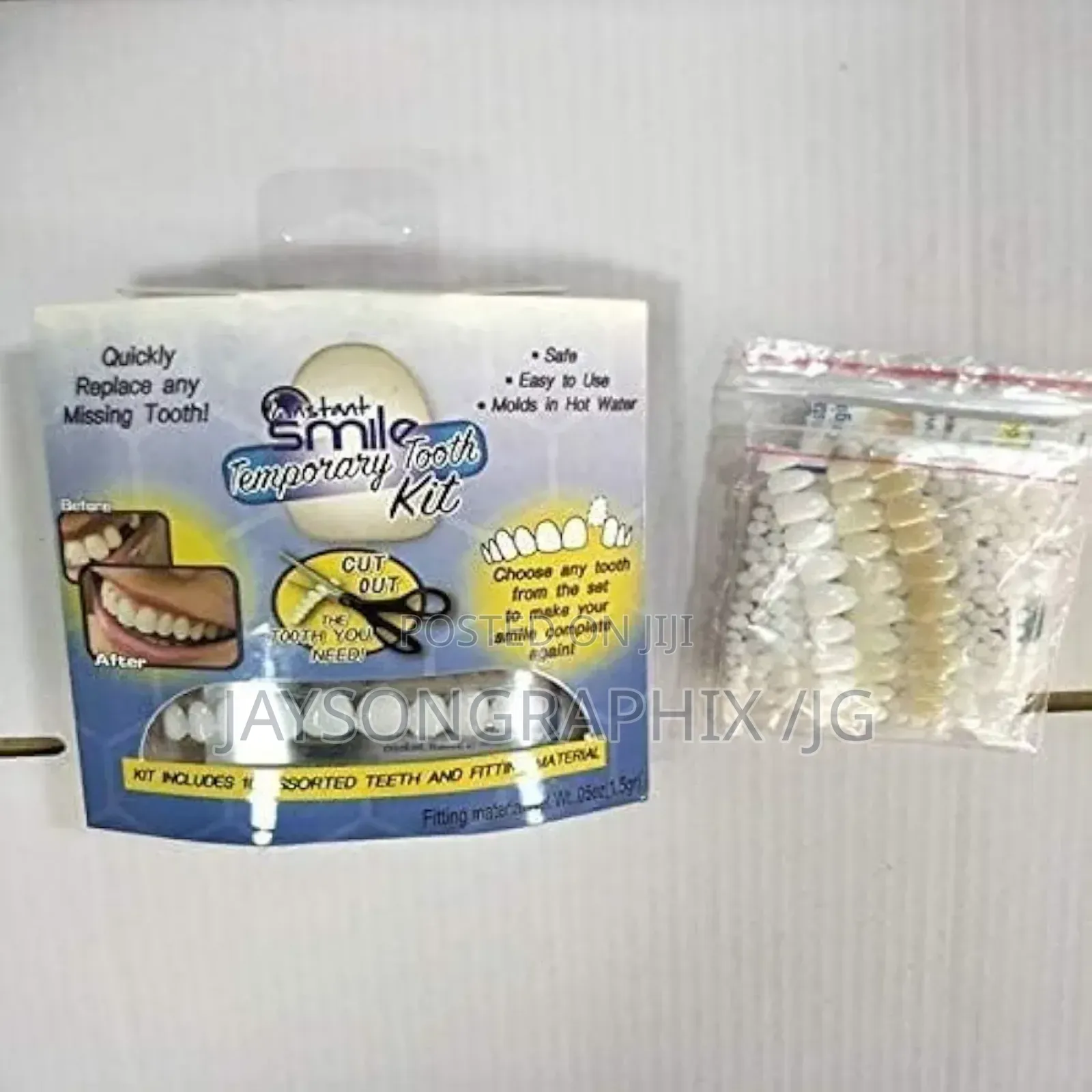 Instant Smile Temporary Tooth Kit