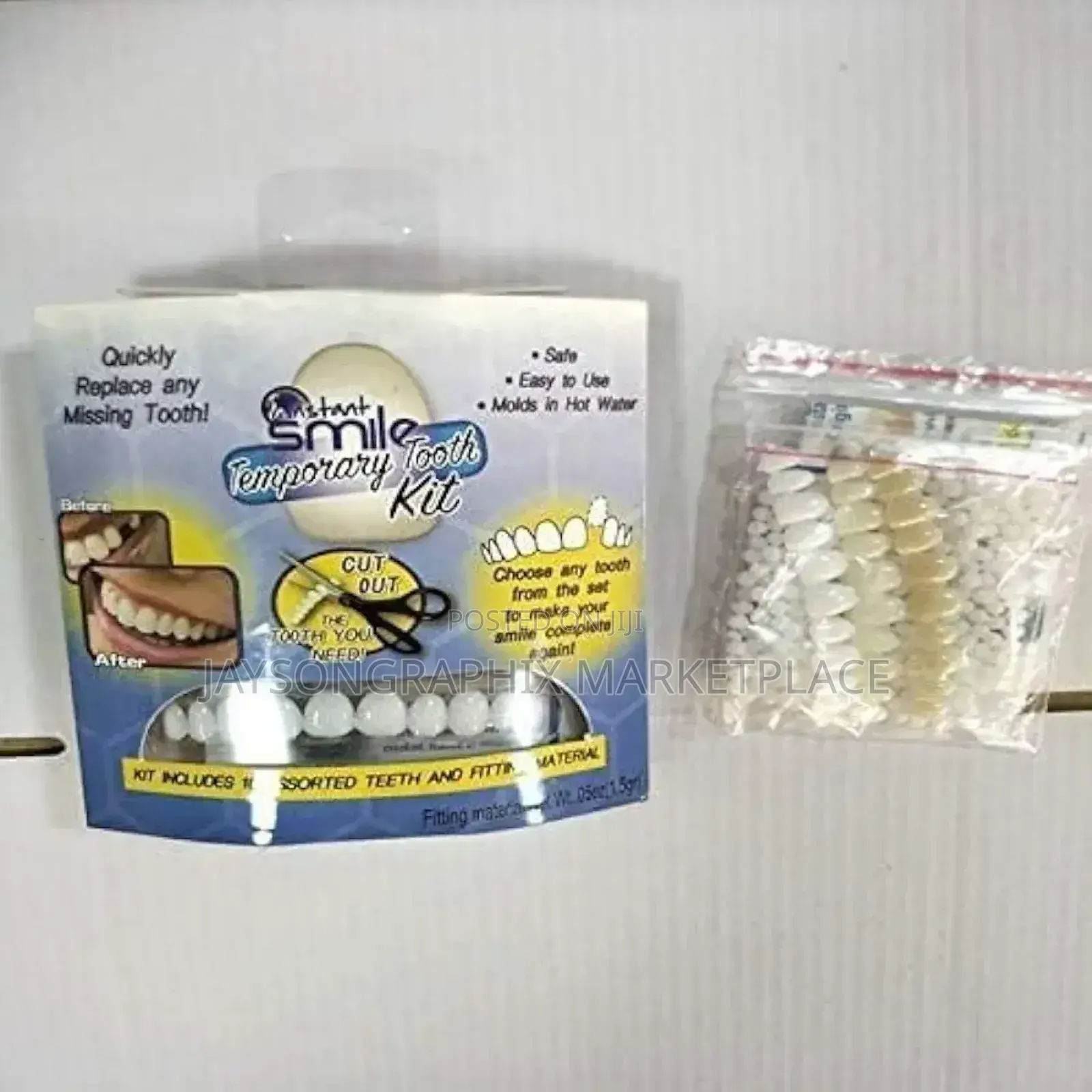 Instant Smile Temporary Tooth Kit