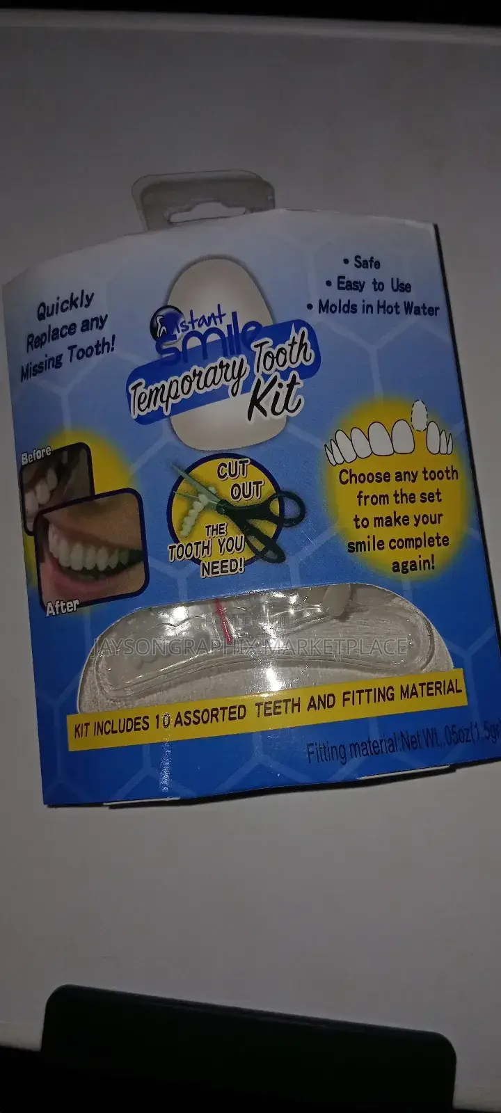 Instant Smile Temporary Tooth Kit