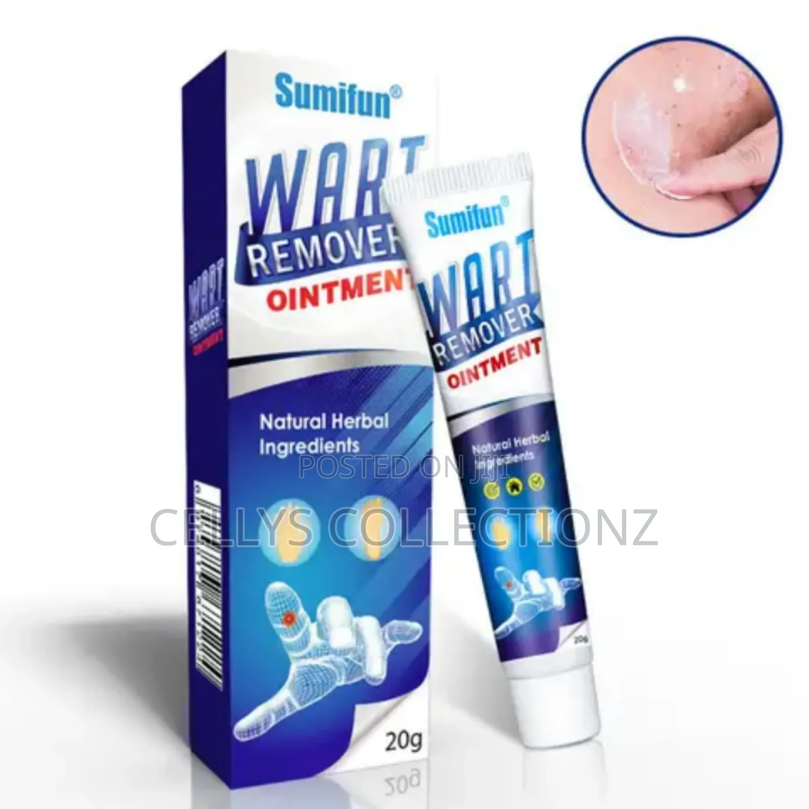 Wart Remover Cream