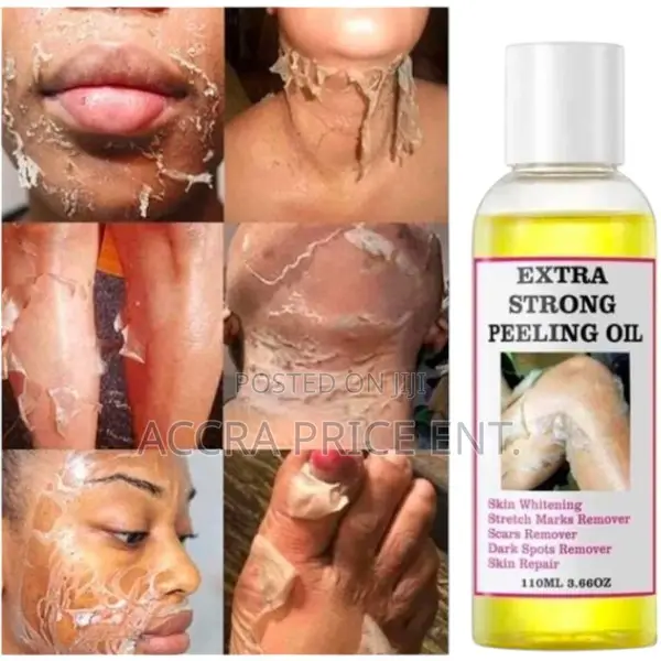Original Extra Strong Peeling Oil (Free Delivery)