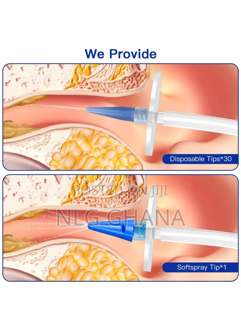 Ear Wax Removal Kit Home Ear Flushing Tvx21079