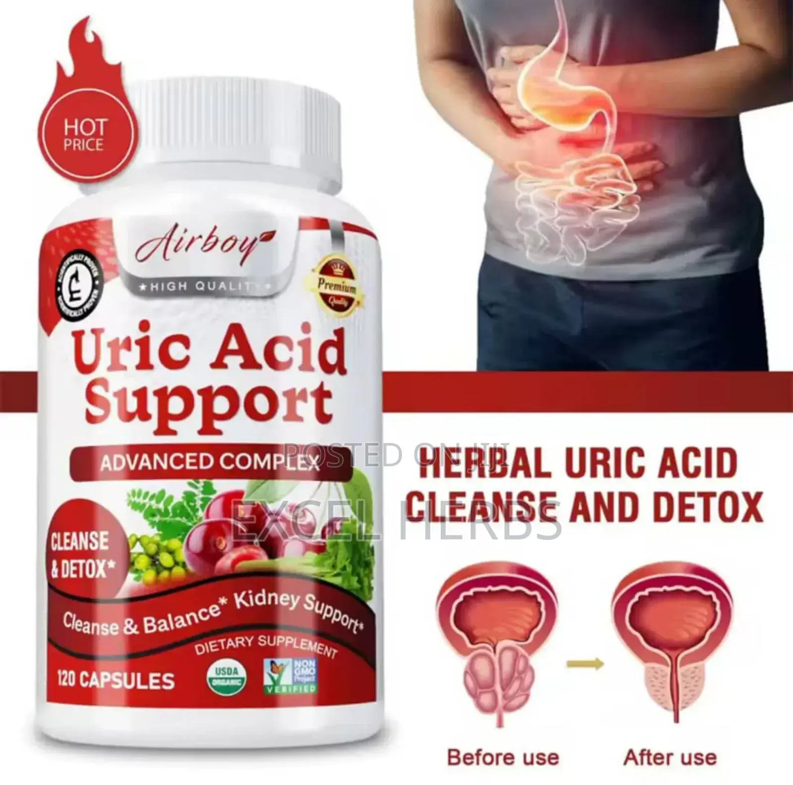 Uric Acid Support (Advanced Complex)