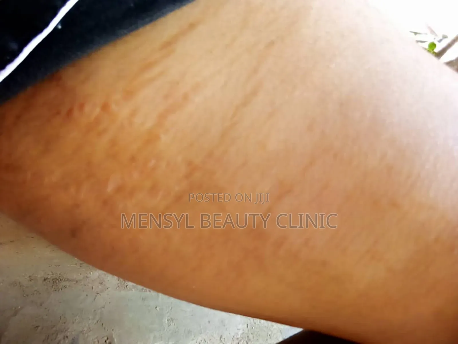 Chemical Peel Gly-Colagen Peeling Solution for Radiant Skin