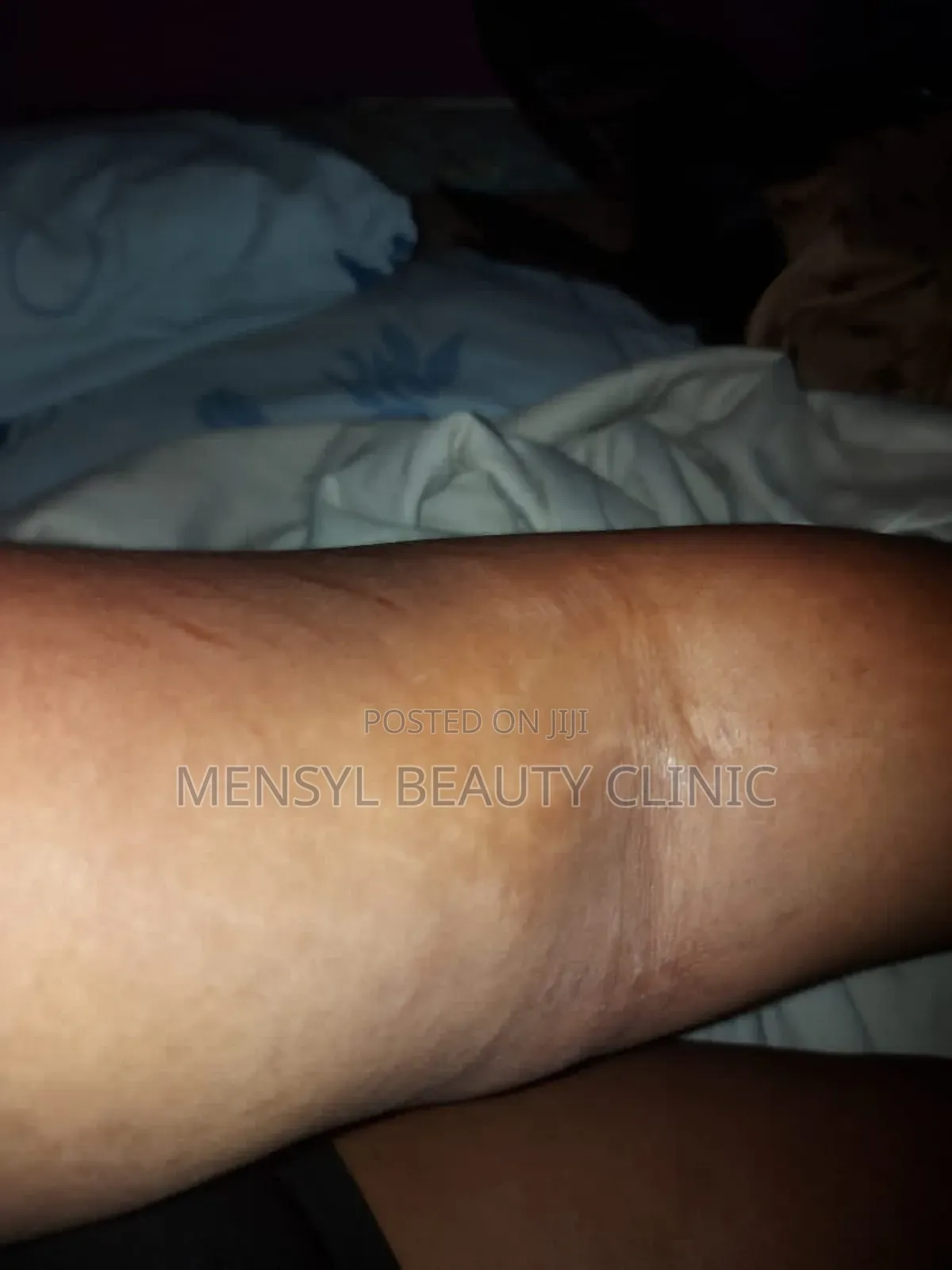 Chemical Peel Gly-Colagen Peeling Solution for Radiant Skin
