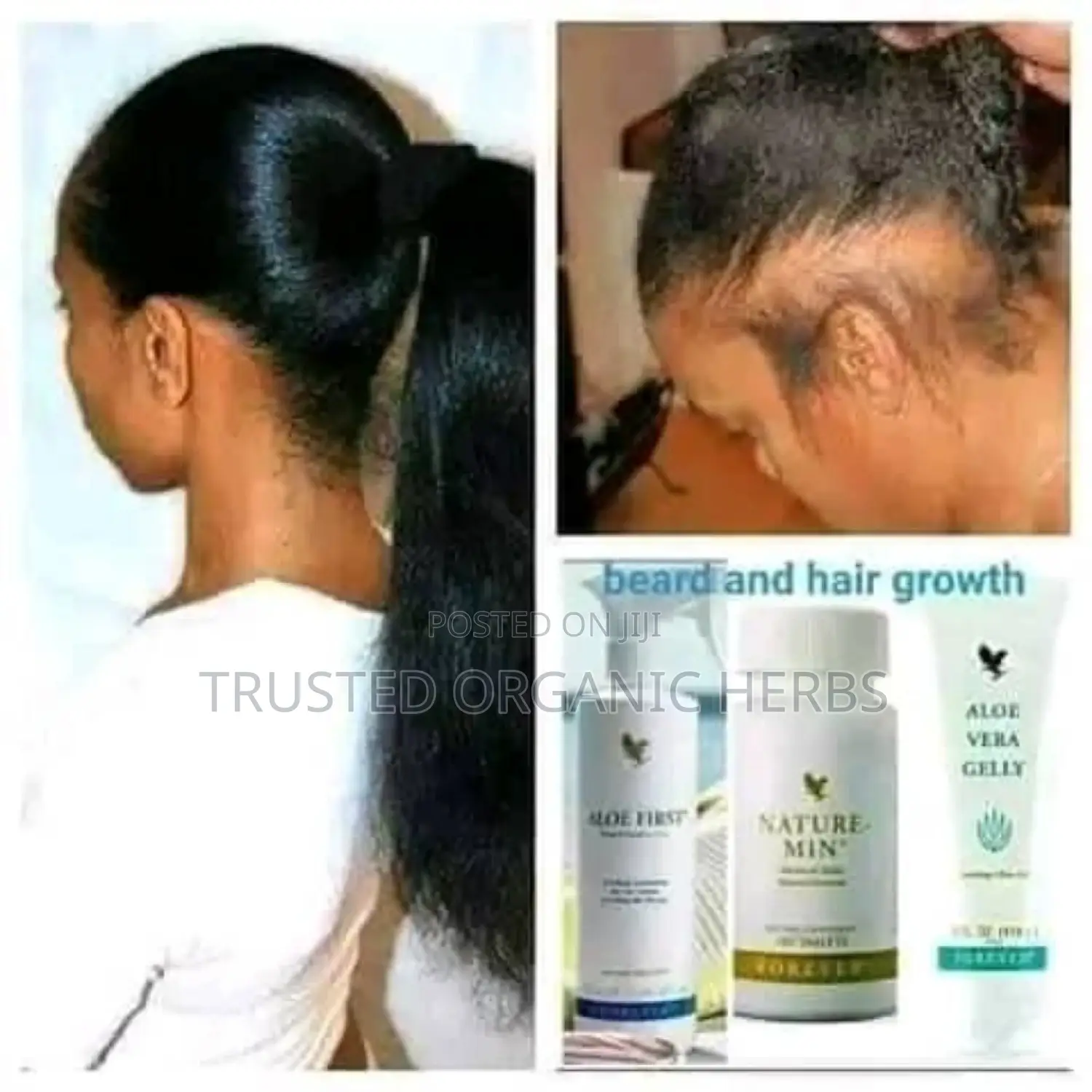 Ladies Hair Growth- Long-Lasting Hair