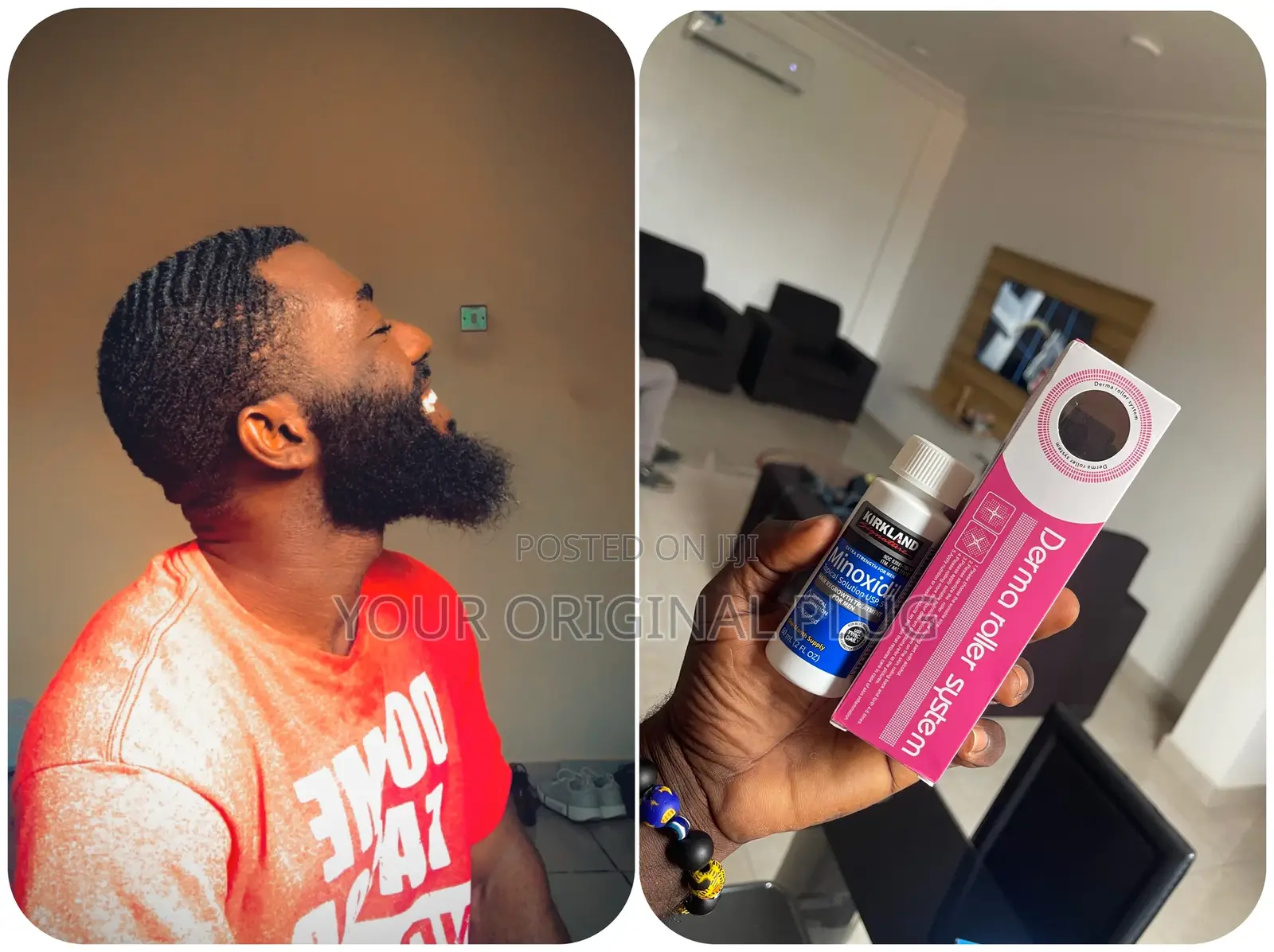 Kirkland Minoxidil + Derma Roller (Best Combo)