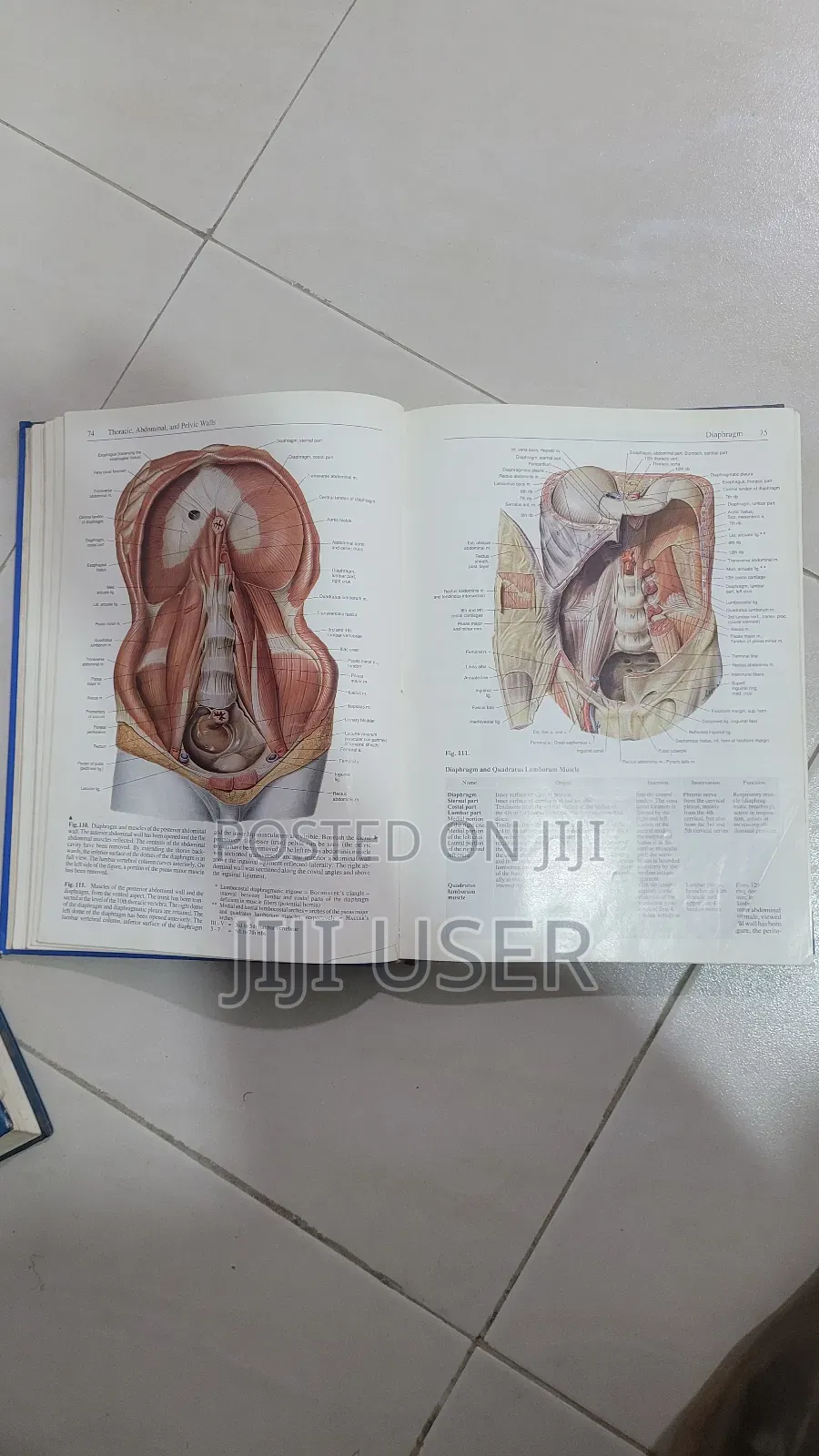 Sobotta Atlas of Human Anatomy