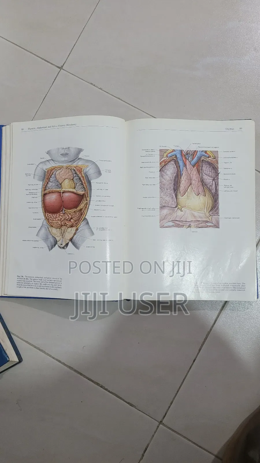 Sobotta Atlas of Human Anatomy
