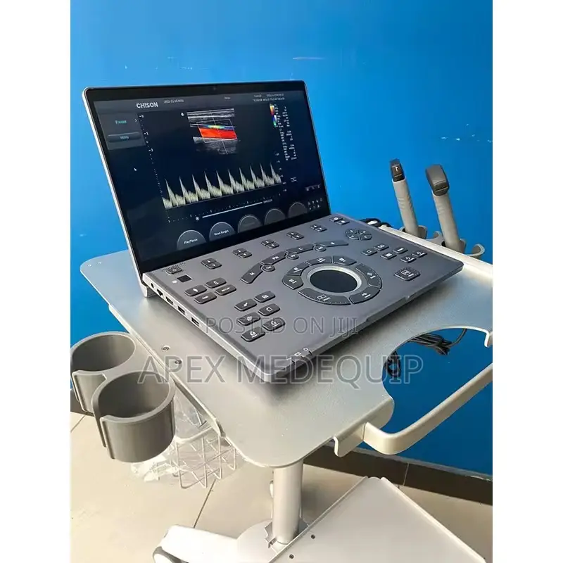 Chison Sonoair-70 Portable Ultraslim Color Ultrasound