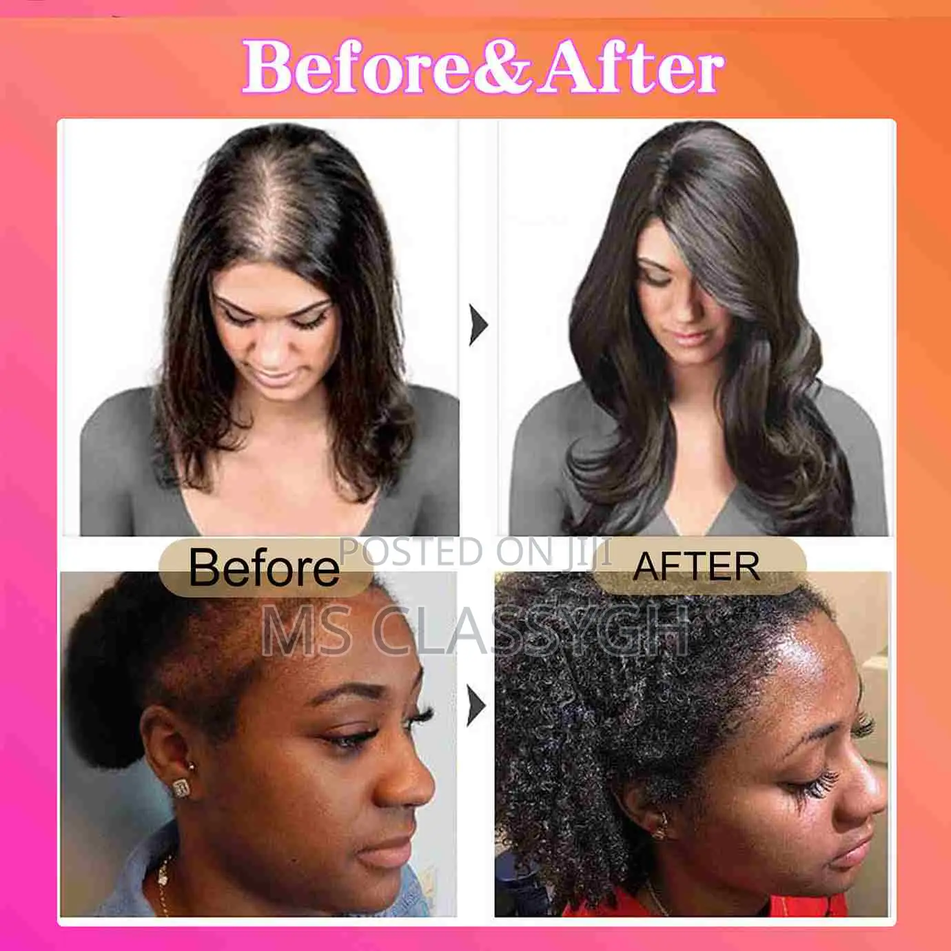 Batana Oil Hair Growth Natural Oil Hair Loss Anti-Breakage