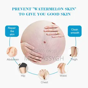 Snail Stretch Mark Cream Removal Stretch Marks Repair Skin