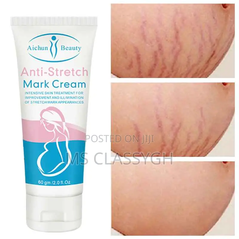 Snail Stretch Mark Cream Removal Stretch Marks Repair Skin