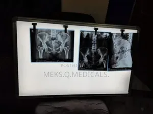 X - Ray View Box Double