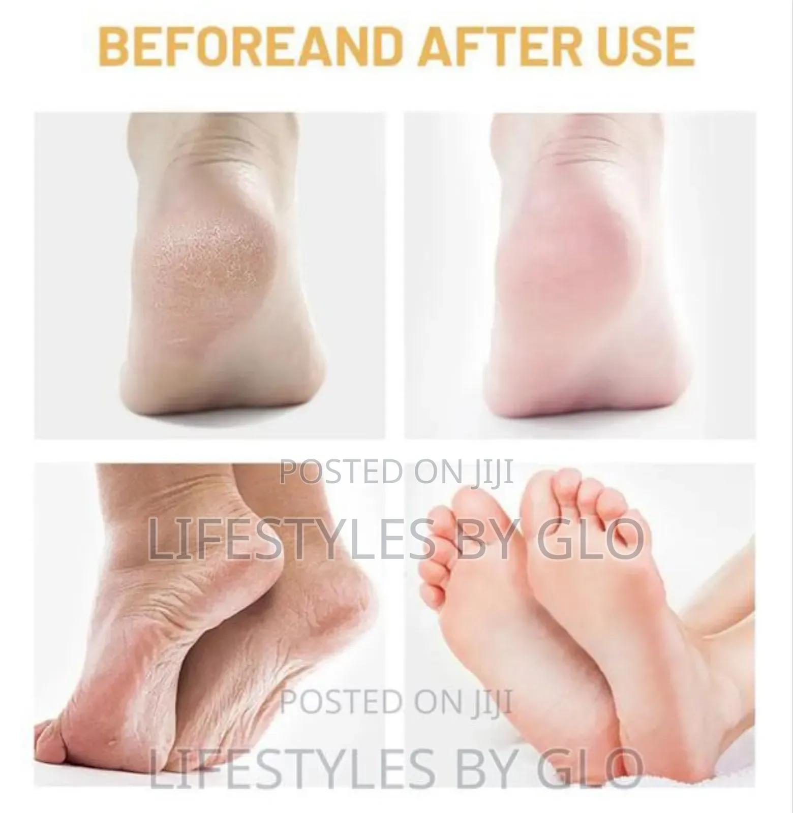 Disaar Moisturizing Collagen Foot Repair Cream