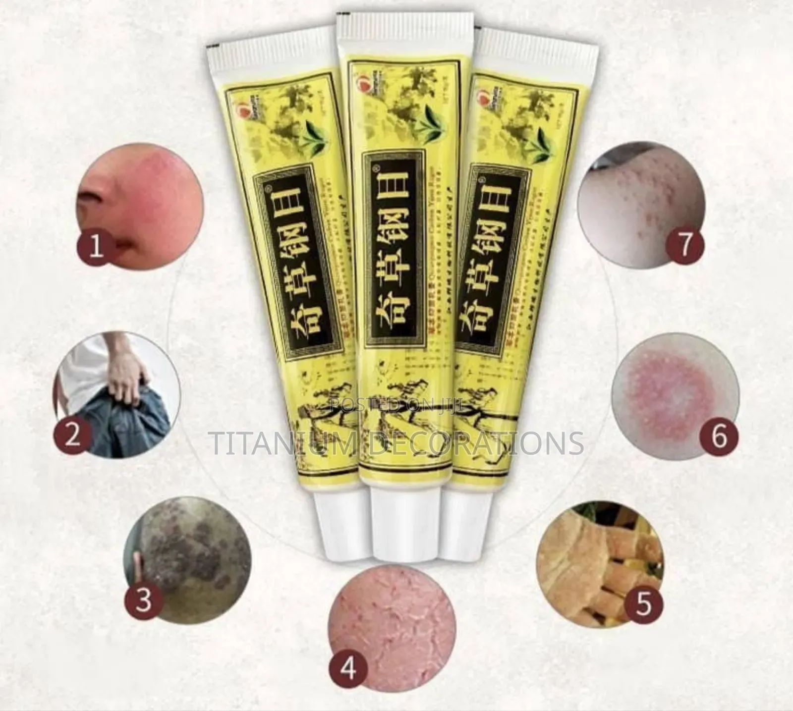 Psoriasis and Eczema Cream