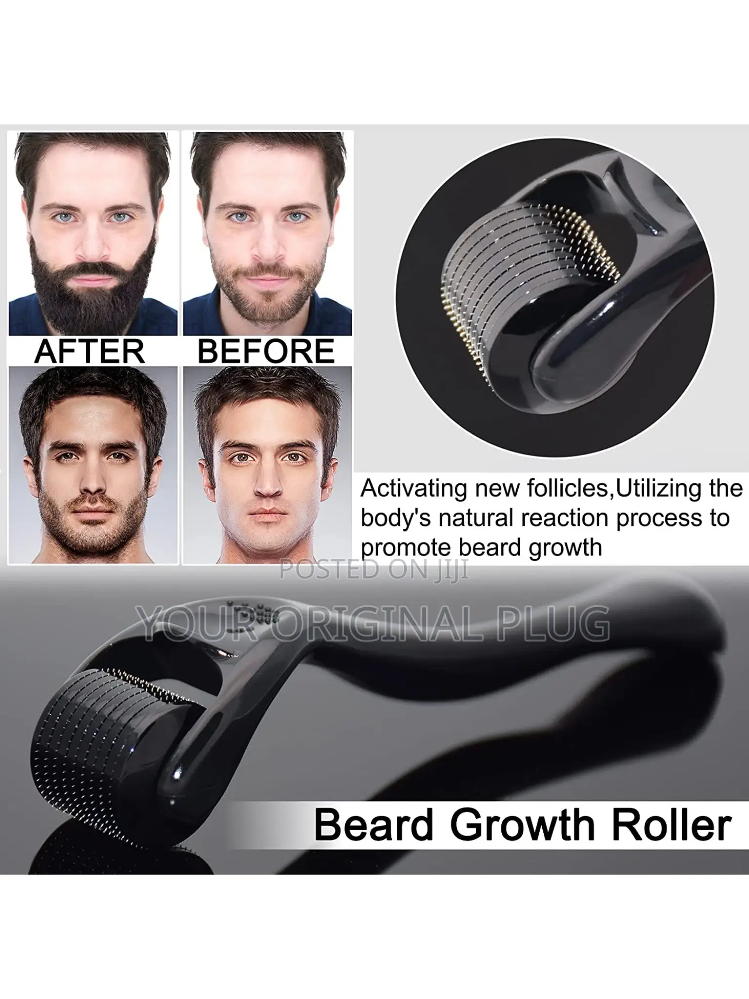 Kirkland Minoxidil + Derma Roller (Beard Growth Baldness)