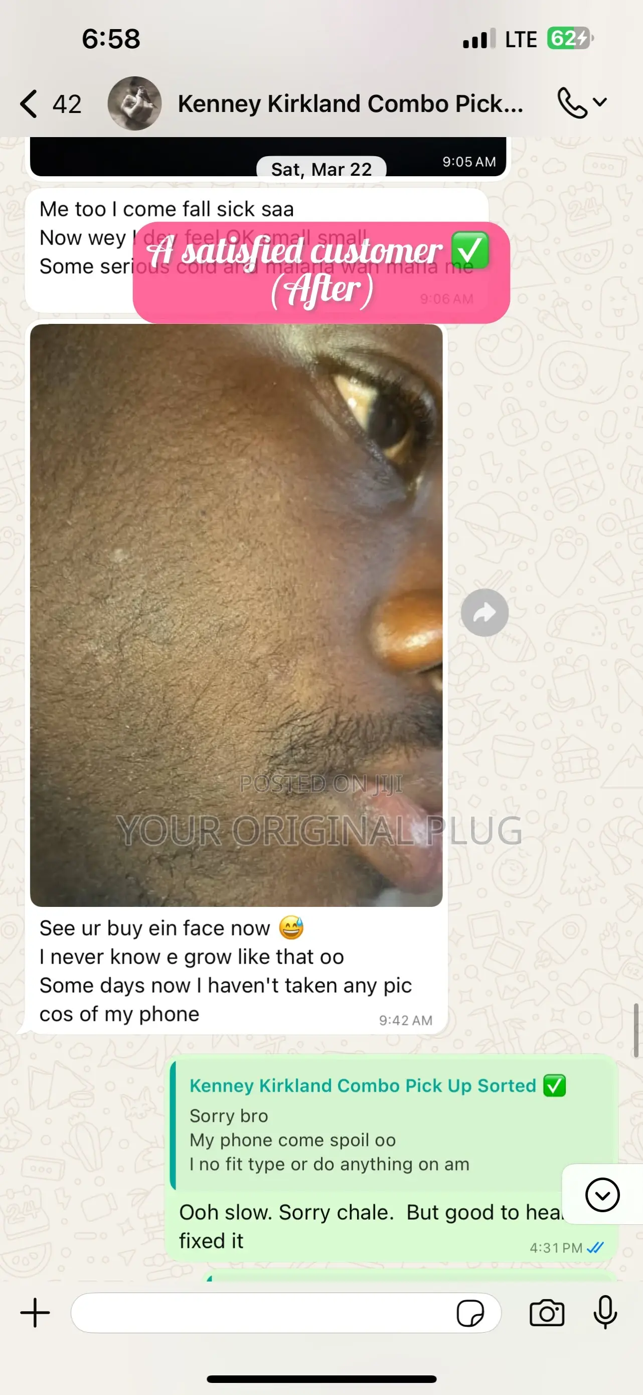 Kirkland Minoxidil + Derma Roller (Beard Growth Baldness)