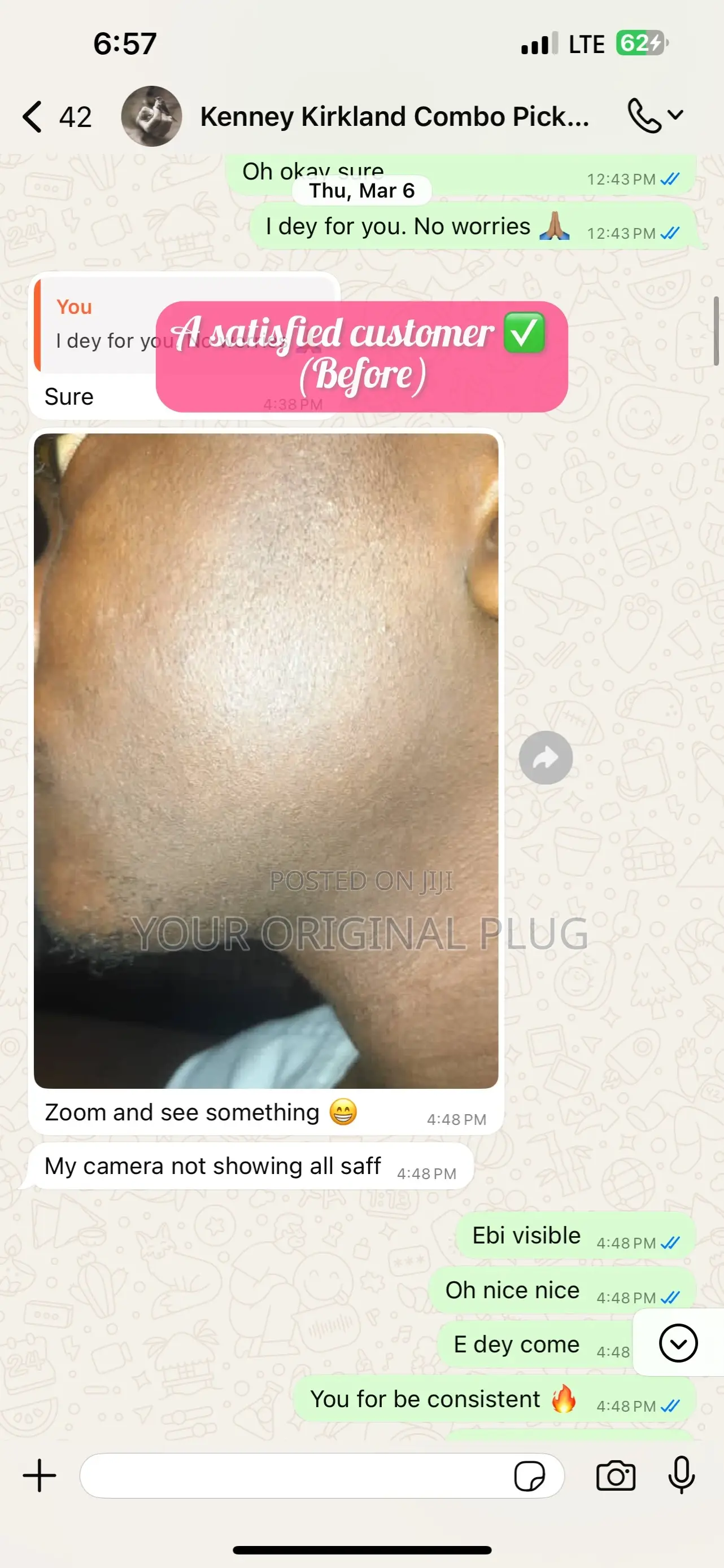 Kirkland Minoxidil + Derma Roller (Beard Growth Baldness)