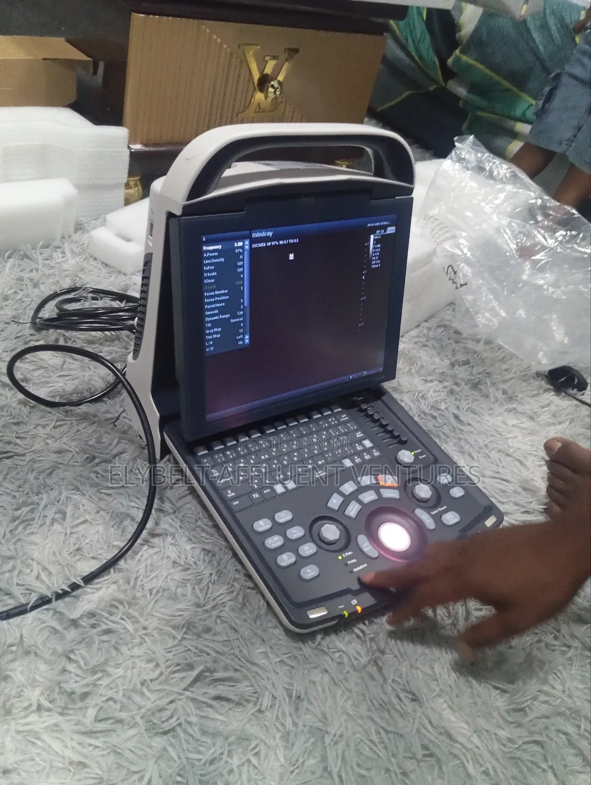 Mindray Dp 10 Ultrasound Scan With Printer