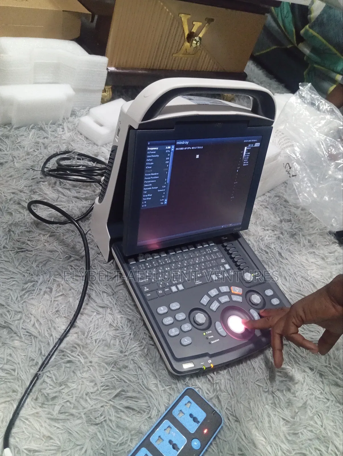 Mindray Dp 10 Ultrasound Scan With Printer