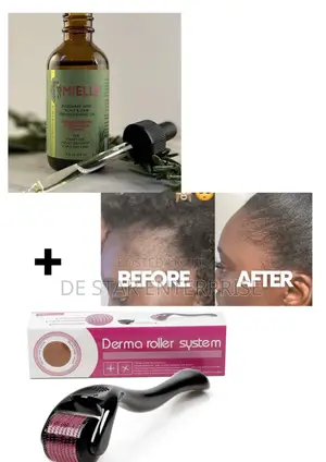Mielle Rosemary Oil + Derma Roller System for Edges