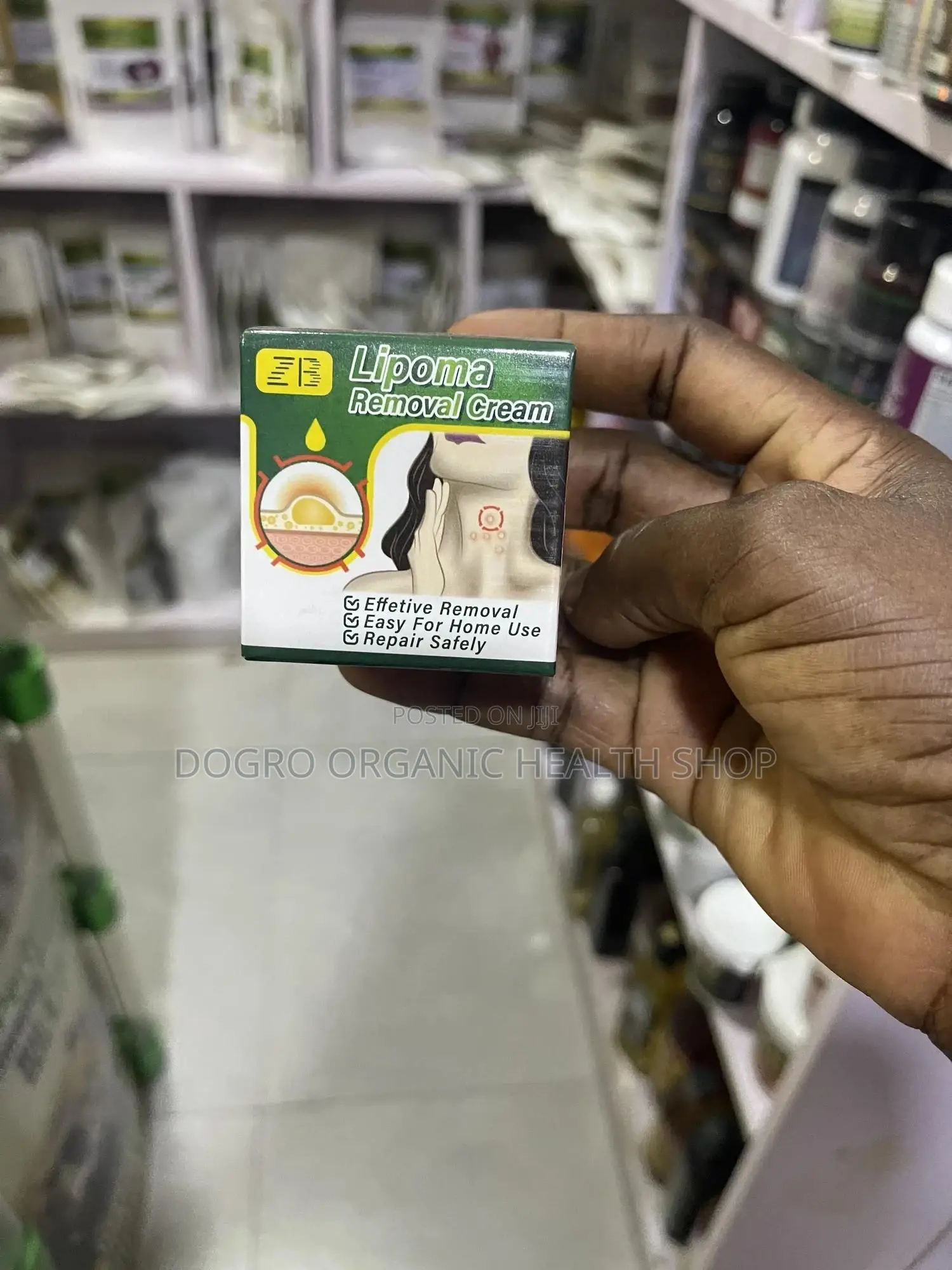 Zb Lipoma Removal Cream